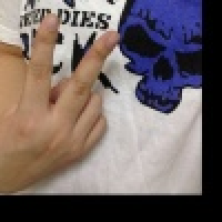 植发星algaunu04207