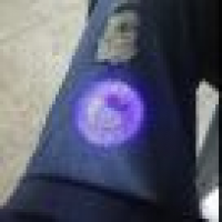 植发星█重量█檞喳2