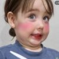 植发星千叶°434