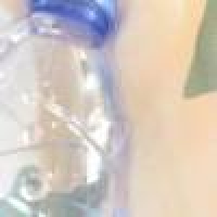 植发星喜上眉梢