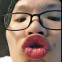 植发星西域甄香