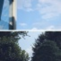 植发星lj358258328