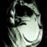 植发星四宝山最靓的仔