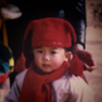 植发星布欧制焉5