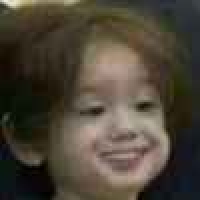 植发星网友_2EDWLB