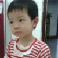 植发星网友_085MXY