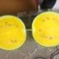 植发星渑池好心人