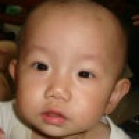 植发星人贱何医