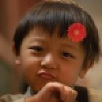 植发星加菲19日52