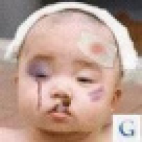 植发星凤凰灬俱