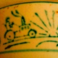 植发星小宁哥哥2604