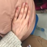 植发星oO悲惨的父母Oo