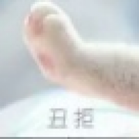 植发星内涵你懂得2c