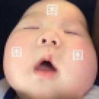 植发星揭阳兄1111111