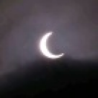 植发星技术1e忟潑